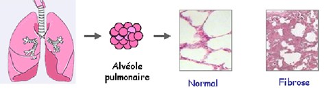 alveole